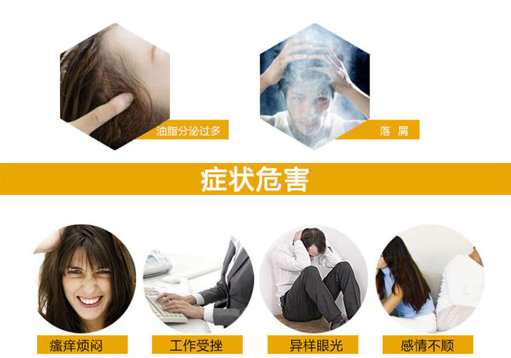 除脂生發(fā)片價(jià)格